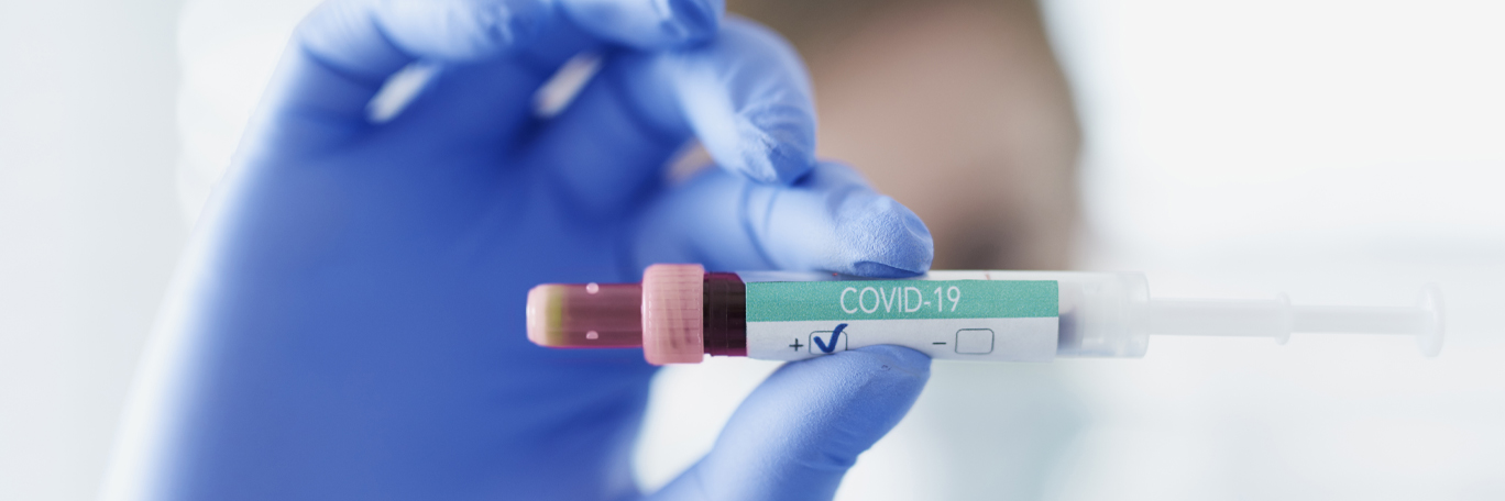 Covid 19, io il tampone e la mia settimana da incubo: un giovane membro della nostra redazione ci racconta la sua avventura da dimenticare.