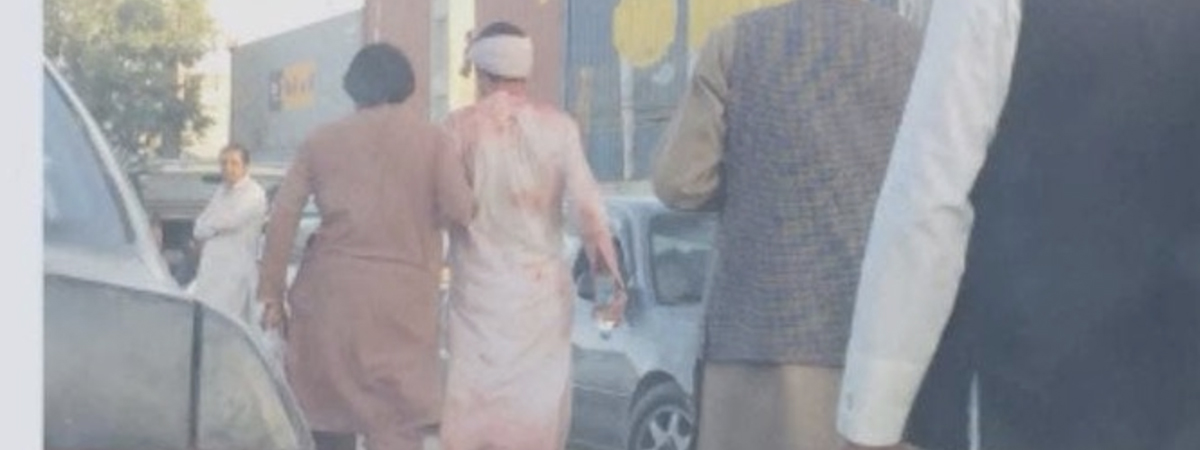 Afghanistan attacco suicida all'aeroporto di Kabul. Sarebbero almeno 13 le vittime dell'attacco. Tra questi ci sarebbero dei bambini.