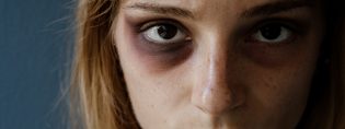 Con l’arrivo della pandemia da Covid-19, la situazione è peggiorata, si è registrato un aumento dei casi di violenza a danno delle donne