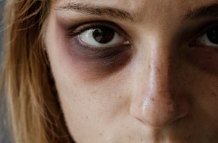 Con l’arrivo della pandemia da Covid-19, la situazione è peggiorata, si è registrato un aumento dei casi di violenza a danno delle donne