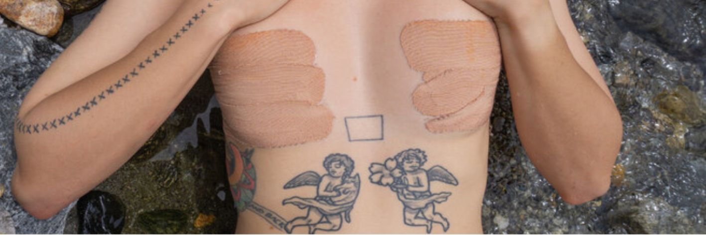 La disforia di genere è una intensa e persistente sofferenza causata dal sentire la propria identità di genere diversa dal proprio sesso. Viene raccontata attraverso le fotografie del progetto Chiamami col mio nome